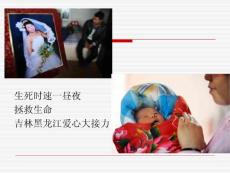 DIC弥散性血管内凝血课件