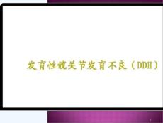 发育性髋关节发育不良ddh课件