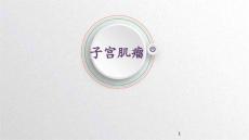 子宫肌瘤课件