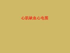 心肌缺血心电图课件