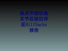 肩关节损伤肩关节后脱位伴反HillSachs损伤培训课件