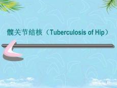 髋关节结核课件