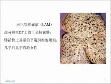 淋巴管肌瘤病的肺部CT表现参考课件