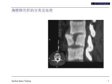 胸腰椎骨折课件
