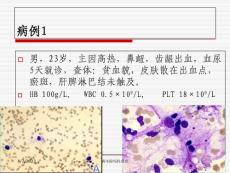 再生障碍性贫血课件