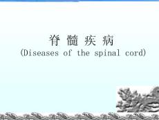 《脊髓压迫症》课件