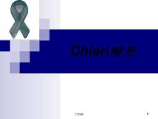 小脑扁桃体下疝(Chiari畸形)课件