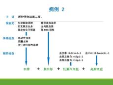 小儿肾病综合征课件