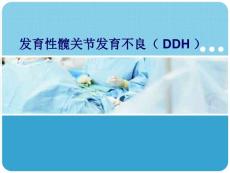 发育性髋关节发育不良.ppt