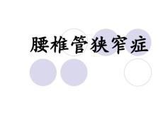 腰椎管狭窄症.ppt