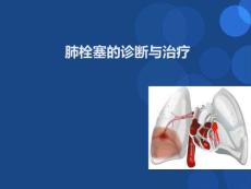 肺栓塞