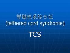 脊髓栓系综合征课件