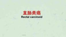 直肠类癌-课件