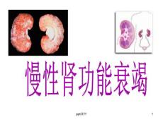 慢性肾功能衰竭--课件