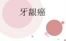 牙龈癌的护理.ppt