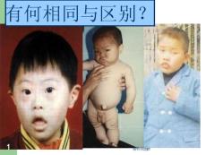 遗传代谢病课件