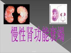 慢性肾功能衰竭课件