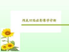 颅底凹陷症影像学诊断课件