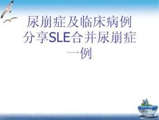 尿崩症及临床病例分享SLE合并尿崩症一例课件