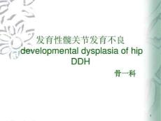 发育性髋关节发育不良课件