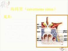 颈动脉海绵窦瘘 ppt课件