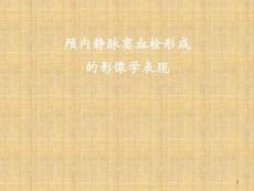 颅内静脉窦血栓形成的特点课件
