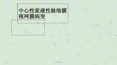 中浆护理查房ppt课件