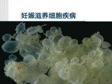 妊娠滋养细胞疾病 课件