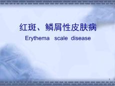红斑、鳞屑性皮肤病[宝典].ppt