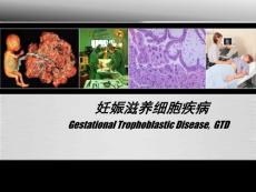 妊娠滋养细胞疾病课件