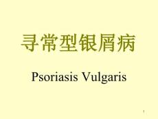 银屑病课件