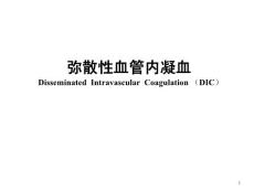 弥散性血管内凝血