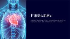 《扩张型心肌病a》课件