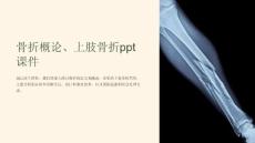 骨折概论、上肢骨折课件