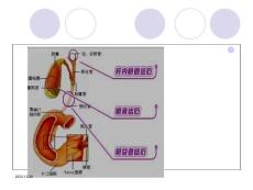 胆囊结石护理课件