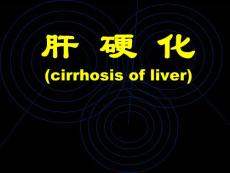 肝硬化-课件