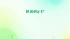 银屑病治疗