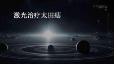激光治疗太田痣