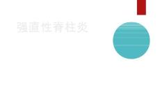 强直性脊柱炎