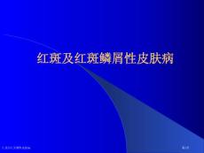 红斑和红斑鳞性皮肤病专家讲座