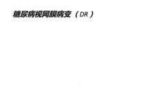 糖尿病视网膜病变