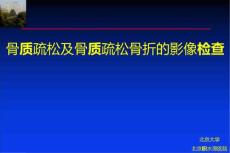 骨质疏松与骨质疏松骨折的影像检查课件