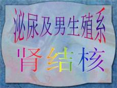 肾结核-课件