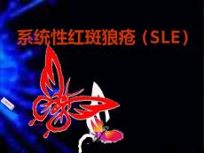 系统性红斑狼疮课件