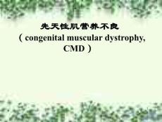 先天性肌营养不良课件