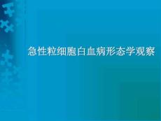 急性粒细胞白血病形态学观察