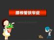 腰椎管狭窄症课件