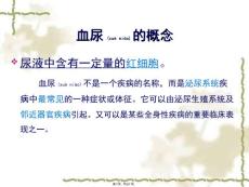 医学专题小儿血尿的鉴别.ppt