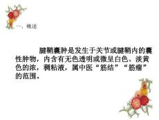 腱鞘囊肿治疗方法.ppt