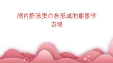 颅内静脉窦血栓形成的影像学表现